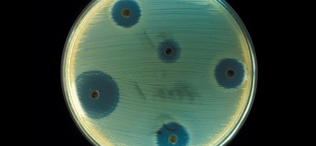 antybiotyki antybiotyki